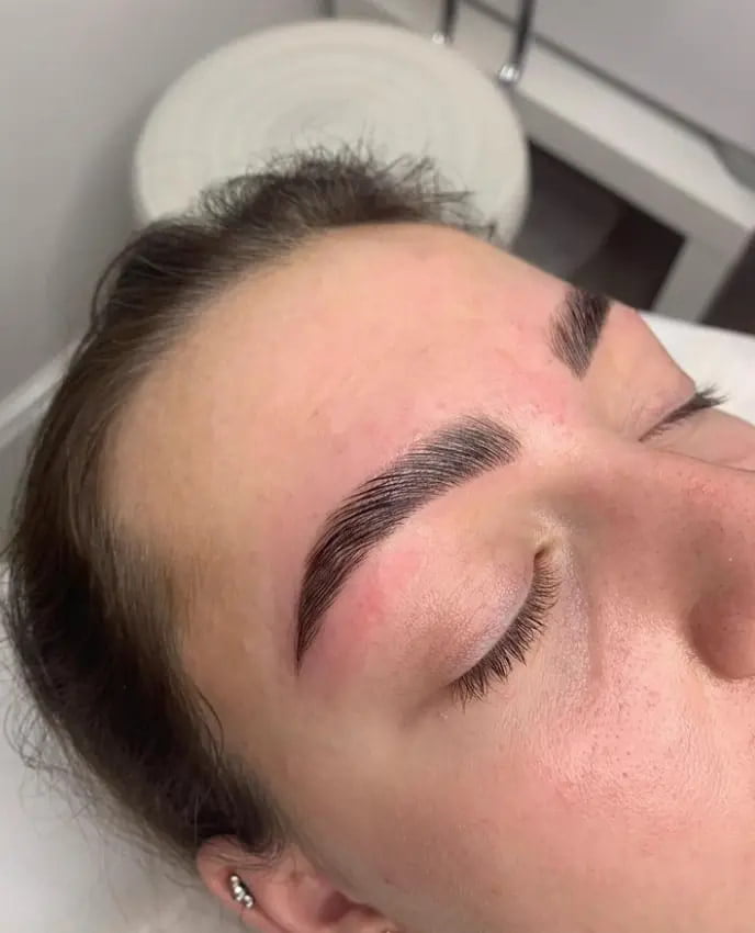 example of allergic reaction brow lamination