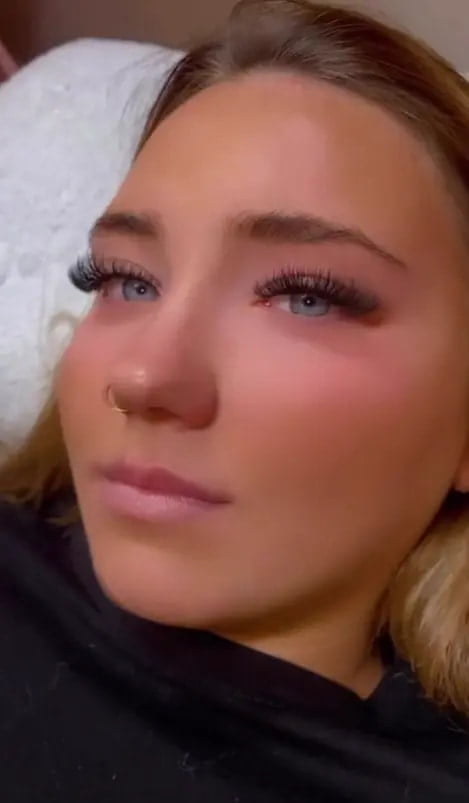 example of hybrid cat eye